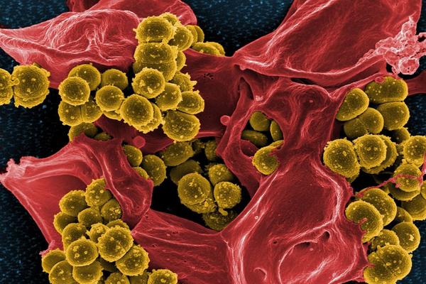 Batteri, virus, funghi, parassiti: come si trasmettono, come si prevengono